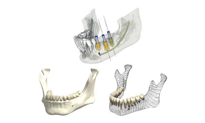 シミュレーション