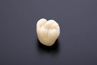 ジルコニアクラウン