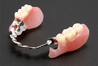 金属床（部分義歯）